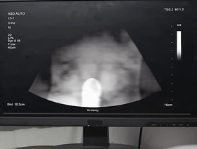 Emergency Dick - Uncut  MEN   Benjamin Blue, Clark Delgaty, Tony D'Angelo, Dane Jaxson    stream full at  www.sexmen.com star gay korean dildo porn