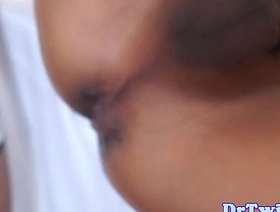 Asian MD slams patient after enema hot gay porn public