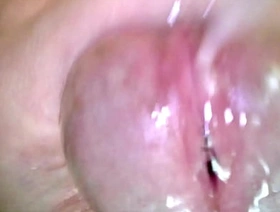 Korslaveman - Sounding with an endoscopic camera gay asian muscle rub down porn